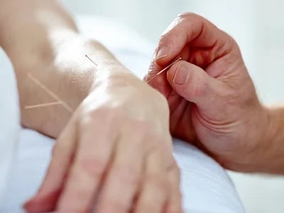Hogyan segít az akupunktura a krónikus fájdalom ellen? – Akupunkturbehandlungen usw