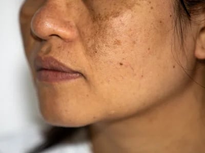 Ästhetische Innovation mit harmony ca bei MorySkin entdecken