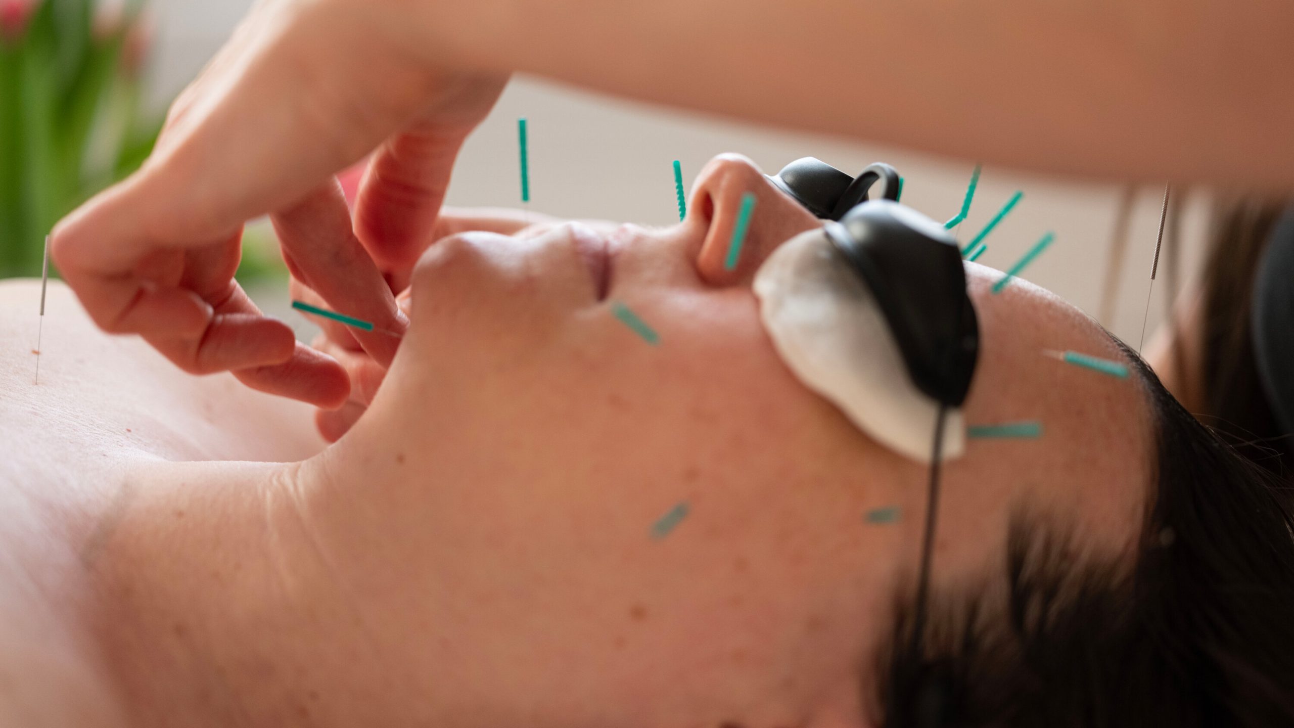 Hogyan segít az akupunktura a krónikus fájdalom ellen? – Akupunkturbehandlungen usw